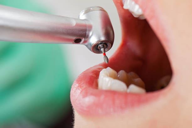 Best Emergency Treatment for Toothache in Gretna, VA